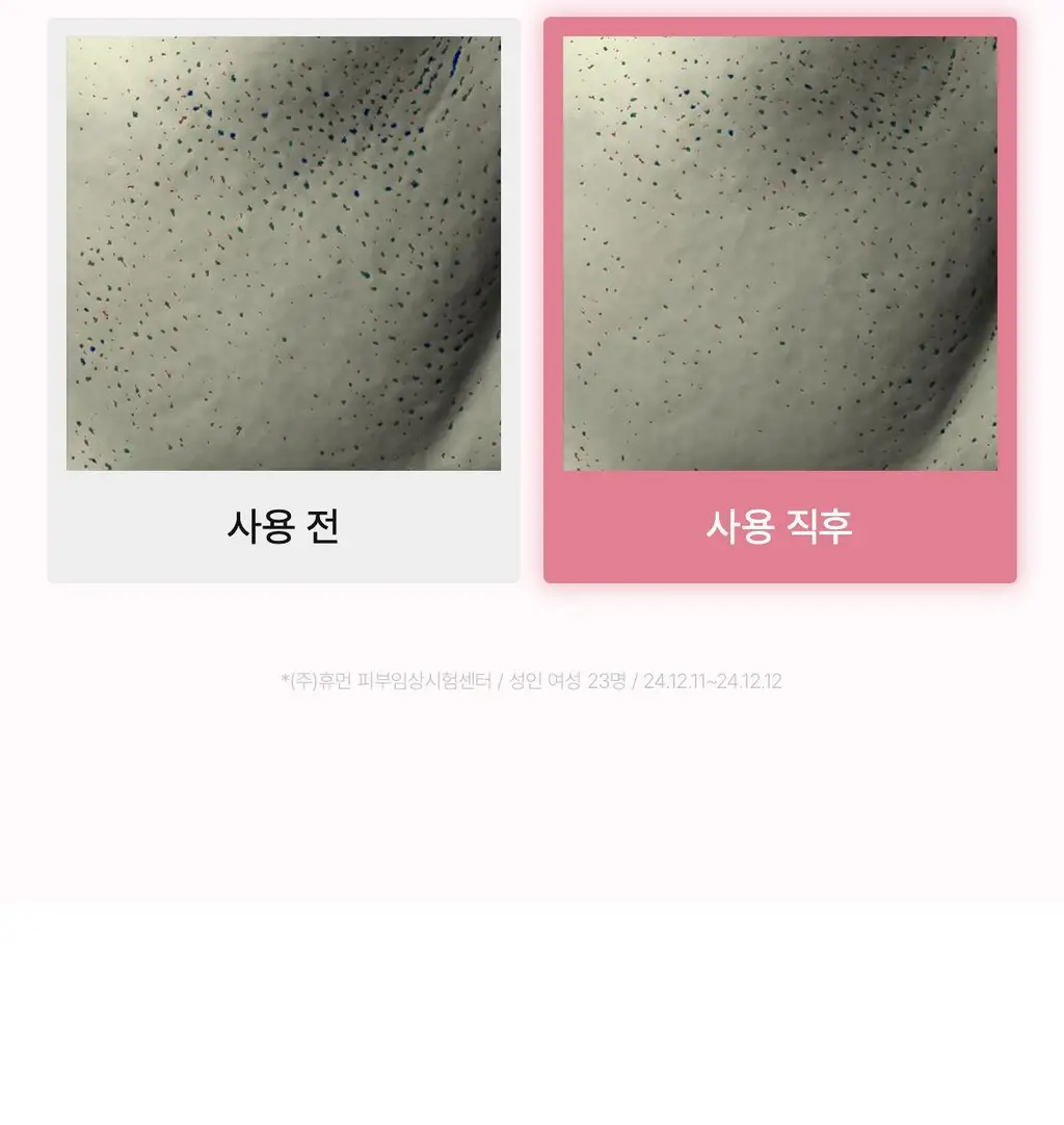 [탄탄모공/피지순삭] 바이오던스 콜라겐 클렌징 오일 200ml 단품/기획 상세페이지 26